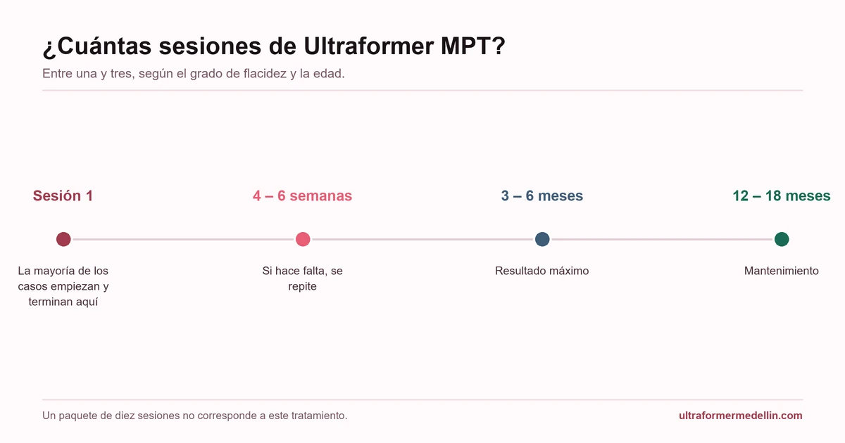 Cronología de sesiones del Ultraformer MPT: primera sesión, repetición a las 4–6 semanas, resultado máximo a los 3–6 meses y mantenimiento a los 12–18 meses
