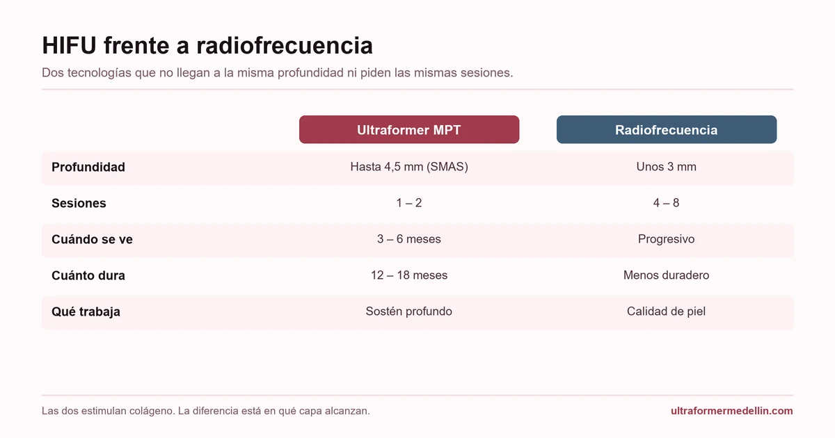 Comparación entre HIFU y radiofrecuencia: profundidad, número de sesiones, cuándo se ve el resultado y cuánto dura