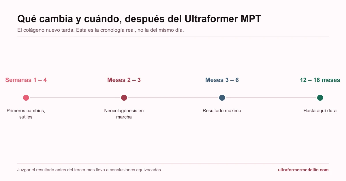 Cronología de resultados del Ultraformer MPT: primeros cambios entre la semana 1 y la 4, neocolagénesis entre el mes 2 y el 3, resultado máximo entre el mes 3 y el 6