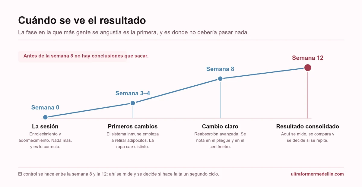 Línea de tiempo de la criolipólisis: semana 0 sin cambios, semanas 3 y 4 primeros cambios, semana 8 cambio claro y semana 12 resultado consolidado