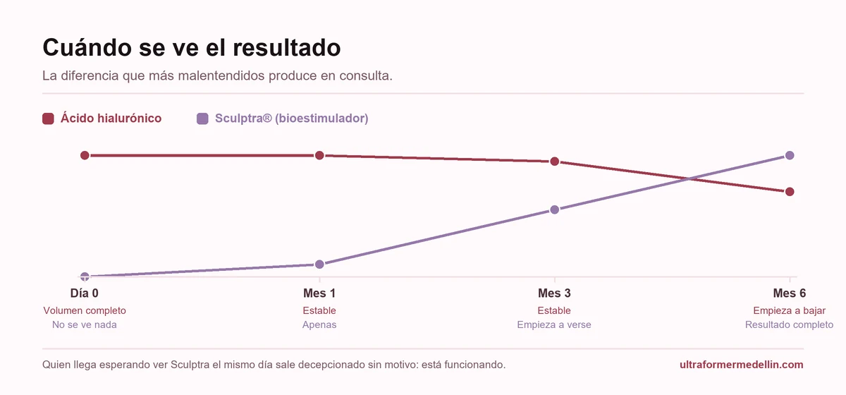 Línea de tiempo comparando el ácido hialurónico, que da volumen el mismo día, con Sculptra, cuyo resultado aparece entre los 3 y los 6 meses