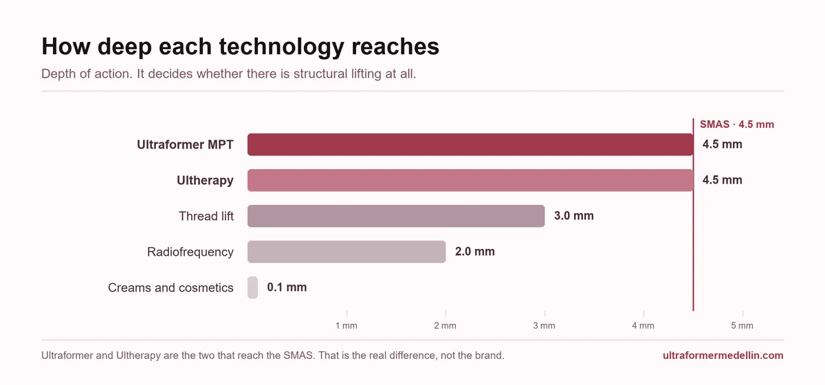 Chart comparing the depth each technology reaches: Ultraformer MPT and Ultherapy 4.5 mm, thread lift 3 mm, radiofrequency 2 mm