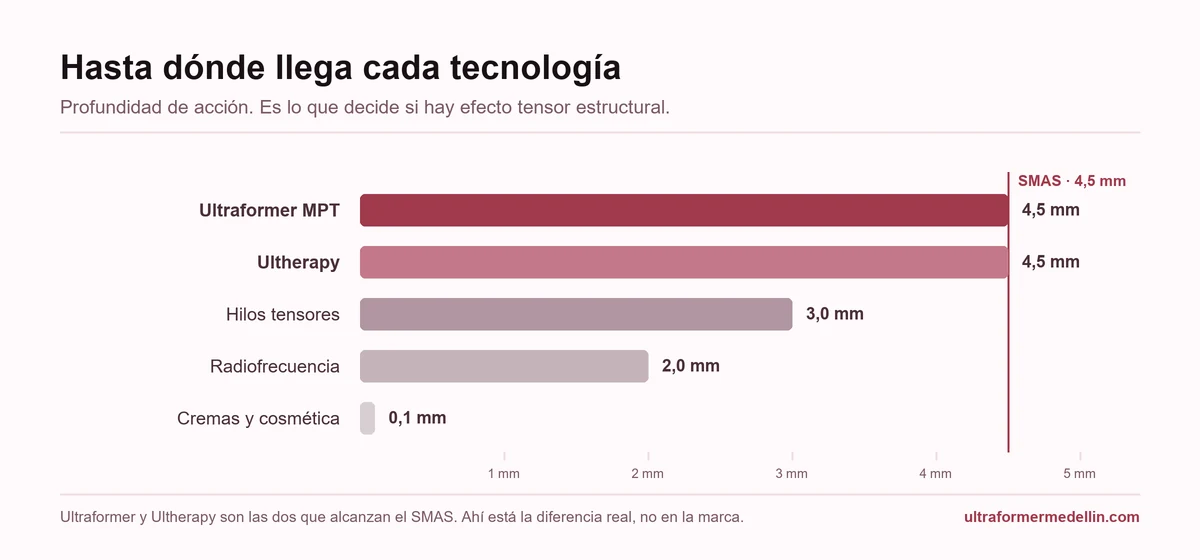 Gráfico comparativo de la profundidad que alcanza cada tecnología: Ultraformer MPT y Ultherapy 4,5 mm, hilos tensores 3 mm, radiofrecuencia 2 mm