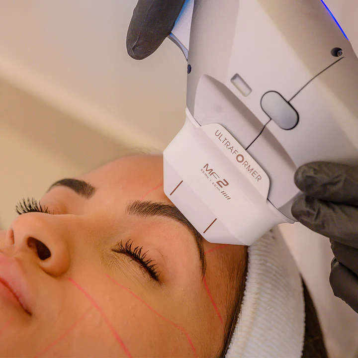Ultraformer MPT Medellín — Lifting facial sin cirugía en El Poblado